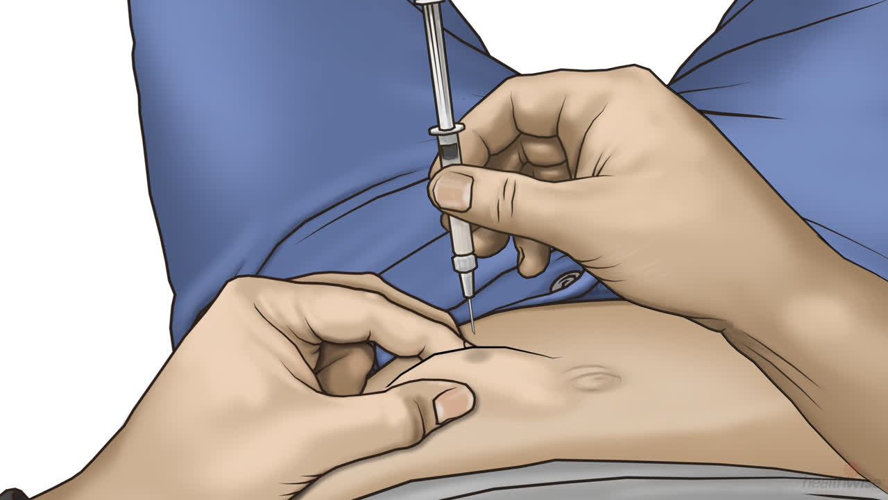 Injeção subcutânea no abdómen com seringa de insulina